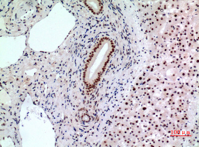 Immunohistochemical analysis of paraffin-embedded human-liver, antibody was diluted at 1:100