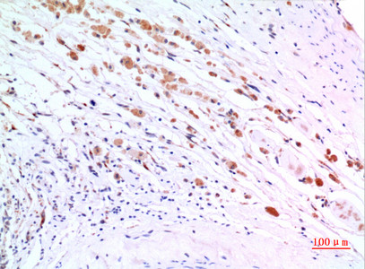 Immunohistochemical analysis of paraffin-embedded human-brain, antibody was diluted at 1:100