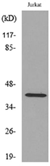 Western blot analysis of extracts from Jurkat cells, using E2F4 (Ab-96) Antibody.