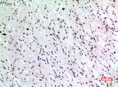Immunohistochemical analysis of paraffin-embedded human-brain, antibody was diluted at 1:100