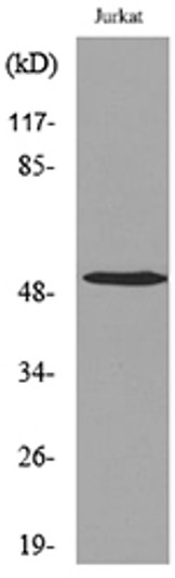 Western blot analysis of extracts from Jurkat cells, using TUBA1A (Ab-40) Antibody.