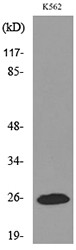 Western blot analysis of lysate from K562 cells, using IGFBP6 Antibody.