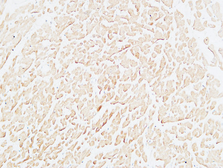 Immunohistochemical analysis of paraffin-embedded Human heart. 1, Antibody was diluted at 1:200 (4°C overnight). 2, High-pressure and temperature EDTA, pH8.0 was used for antigen retrieval. 3, Secondary antibody was diluted at 1:200 (room temperature, 30min).
