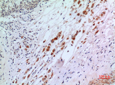 Immunohistochemical analysis of paraffin-embedded human-brain, antibody was diluted at 1:100