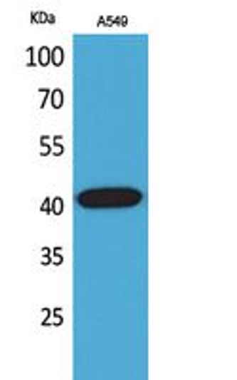 Western blot analysis of A549 cells using L-Selectin Polyclonal Antibody.. Secondary antibody was diluted at 1:20000