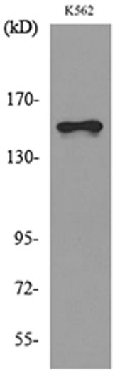 Western blot analysis of lysate from K562 cells, using LAMC2 Antibody.