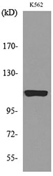 Western blot analysis of lysate from K562 cells, using NLRP3 Antibody.