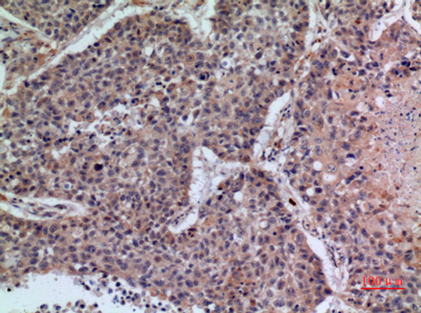 Immunohistochemical analysis of paraffin-embedded human-lung, antibody was diluted at 1:100