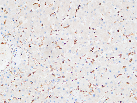Immunohistochemical analysis of paraffin-embedded Human liver. 1, Antibody was diluted at 1:200 (4°C overnight). 2, High-pressure and temperature EDTA, pH8.0 was used for antigen retrieval. 3, Secondary antibody was diluted at 1:200 (room temperature, 30min).