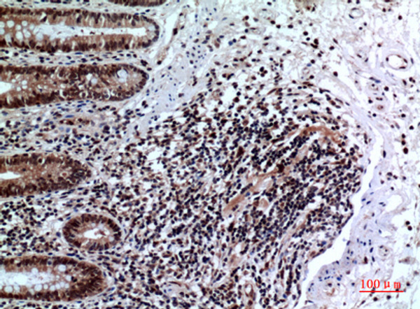 Immunohistochemical analysis of paraffin-embedded human-colon, antibody was diluted at 1:100