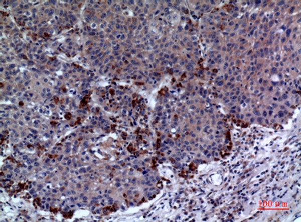 Immunohistochemical analysis of paraffin-embedded human-lung, antibody was diluted at 1:100
