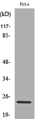 Western blot analysis of lysate from HeLa cells, using RAB5A Antibody.