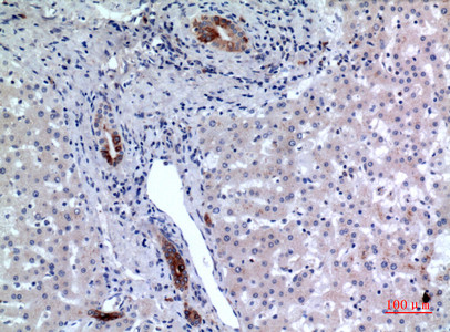 Immunohistochemical analysis of paraffin-embedded human-liver, antibody was diluted at 1:100