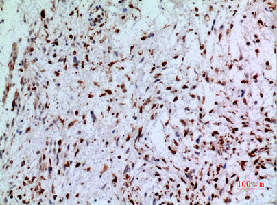 Immunohistochemical analysis of paraffin-embedded human-brain, antibody was diluted at 1:100