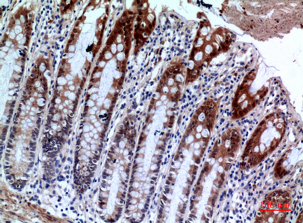Immunohistochemical analysis of paraffin-embedded human-colon, antibody was diluted at 1:100