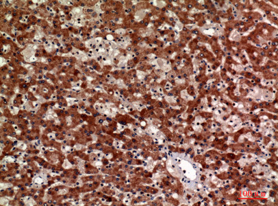Immunohistochemical analysis of paraffin-embedded human-liver, antibody was diluted at 1:100