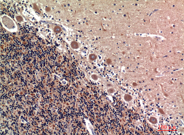Immunohistochemical analysis of paraffin-embedded human-brain, antibody was diluted at 1:100