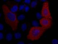 IF analysis of 293T cells transfected with a VSV-G-tagged protein, 1:2000 dilution (blue DAPI, red anti-VSV-G)