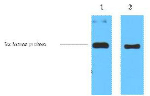 1ug Trx fusion protein+ primary antibody dilution at 1) 1:50002) 1:10000