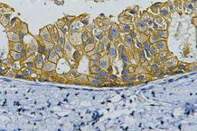 Anti-ERBB2 HER2 antibody 11H9 IHC human breast cancer STJ96947