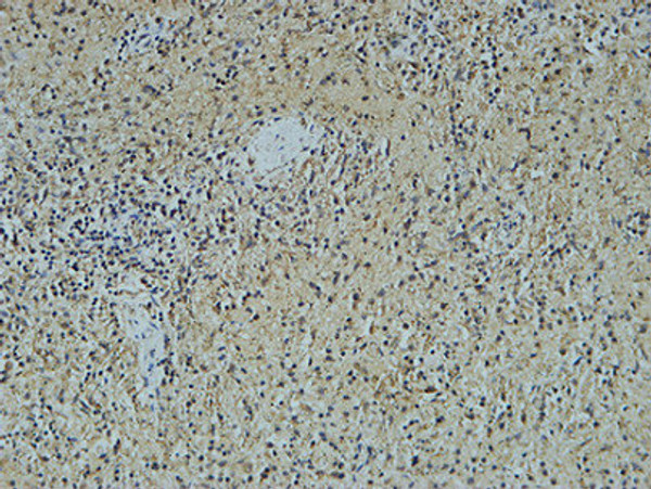 Immunohistochemical analysis of paraffin-embedded Human pancreas. 1, Antibody was diluted at 1:200 (4°C overnight). 2, High-pressure and temperature EDTA, pH8.0 was used for antigen retrieval. 3, Secondary antibody was diluted at 1:200 (room temperature, 30min).