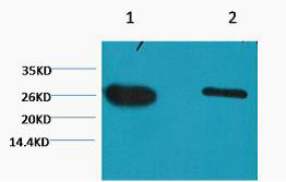 Western blot analysis of GFP-transfected HeLa using Anti-GFP-Tag antibody Mix STJ97026