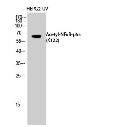 Western blot analysis of HEPG2-UV cells using Acetyl-NF Kappa B-p65 (K122) Polyclonal Antibody diluted at 1:1000. Secondary antibody was diluted at 1:20000 Western blot analysis of HEPG2-UV cells using Acetyl-NF Kappa B-p65 (K122) Polyclonal Antibody diluted at 1:1000. Secondary antibody was diluted at 1:20000