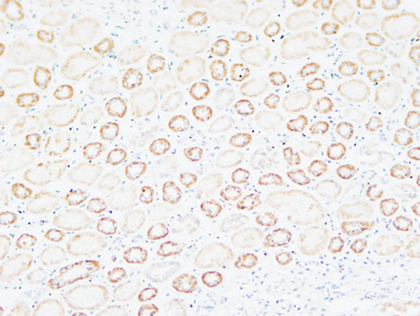 Immunohistochemical analysis of paraffin-embedded Human kidney. 1, Antibody was diluted at 1:200 (4°C overnight). 2, High-pressure and temperature EDTA, pH8.0 was used for antigen retrieval. 3, Secondary antibody was diluted at 1:200 (room temperature, 30min). Immunohistochemical analysis of paraffin-embedded Human kidney. 1, Antibody was diluted at 1:200 (4°C overnight). 2, High-pressure and temperature EDTA, pH8.0 was used for antigen retrieval. 3, Secondary antibody was diluted at 1:200 (room temperature, 30min).