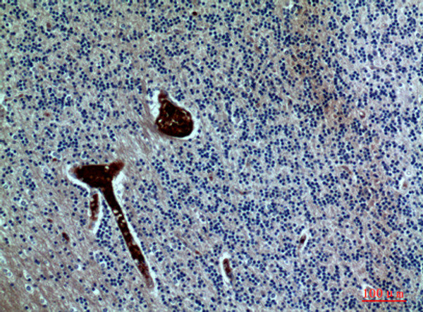 Immunohistochemical analysis of paraffin-embedded human-brain, antibody was diluted at 1:100