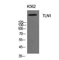Western Blot analysis of K562 cells using Talin-1 Polyclonal Antibody. The antibody was diluted at 1:1000. The STJ97271