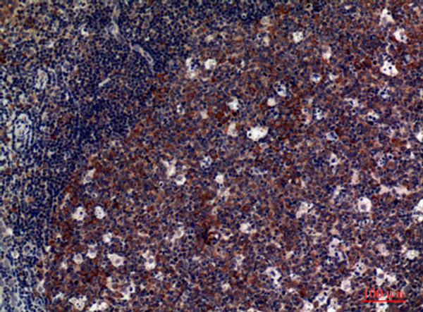 Immunohistochemical analysis of paraffin-embedded human-tonsils, antibody was diluted at 1:100
