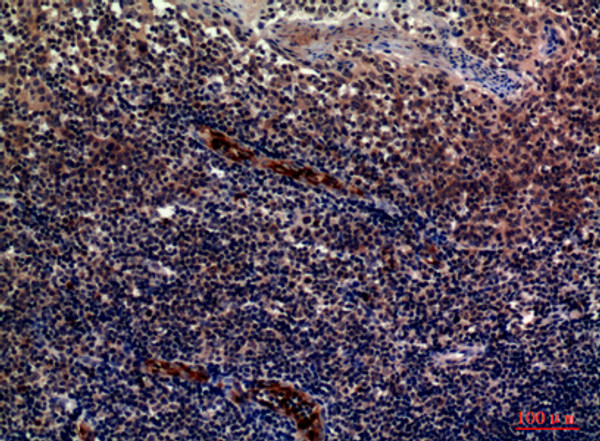 Immunohistochemical analysis of paraffin-embedded human-tonsils, antibody was diluted at 1:100