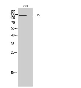 Western Blot analysis of 293 cells using LIFR Polyclonal Antibody. Secondary antibody was diluted at STJ97299