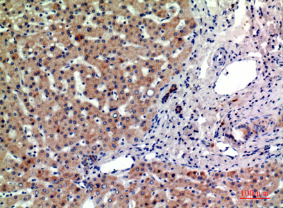 Immunohistochemical analysis of paraffin-embedded human-liver, antibody was diluted at 1:200