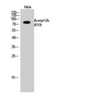 Western blot analysis of Hela cells using Acetyl-Ub (K33) Polyclonal Antibody. Secondary antibody was diluted at 1:20000