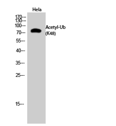 Western blot analysis of Hela cells using Acetyl-Ub (K48) Polyclonal Antibody. Secondary antibody was diluted at 1:20000