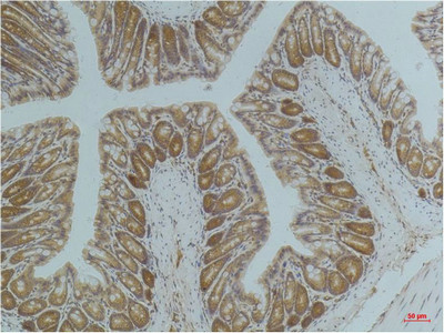 Immunohistochemical analysis of paraffin-embedded Mouse ColonTissue using AMPK a1 Mouse mAb diluted at 1:200.