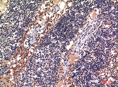 Immunohistochemical analysis of paraffin-embedded human-lymph, antibody was diluted at 1:100