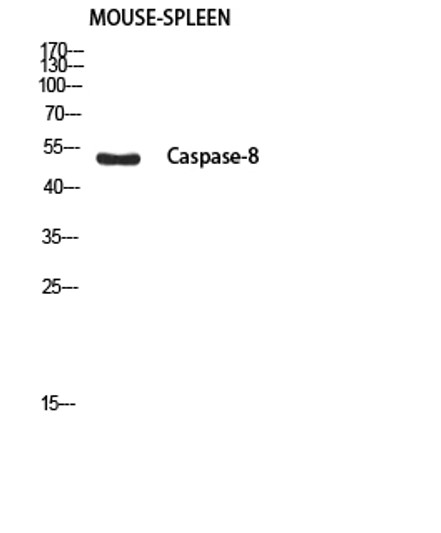 Western blot analysis of mouse spleen using Cleaved-Caspase-8 p18 (S217) antibody. Antibody was diluted at 1:1000. Secondary antibody was diluted at 1:20000