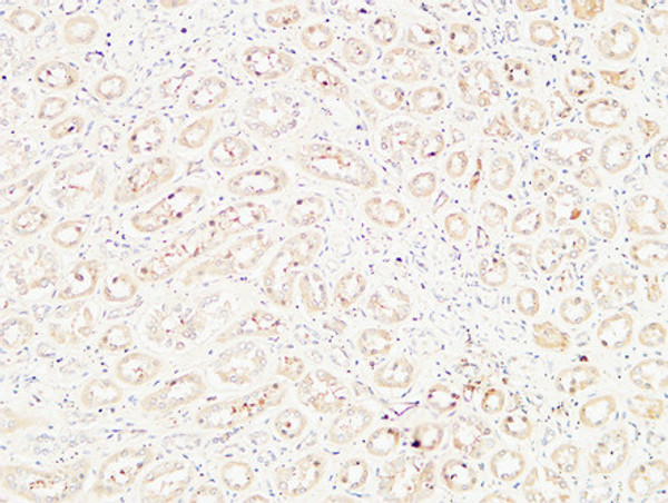 Immunohistochemical analysis of paraffin-embedded Human kidney. 1, Antibody was diluted at 1:100 (4°C overnight). 2, High-pressure and temperature EDTA, pH8.0 was used for antigen retrieval. 3, Secondary antibody was diluted at 1:200 (room temperature, 30min).