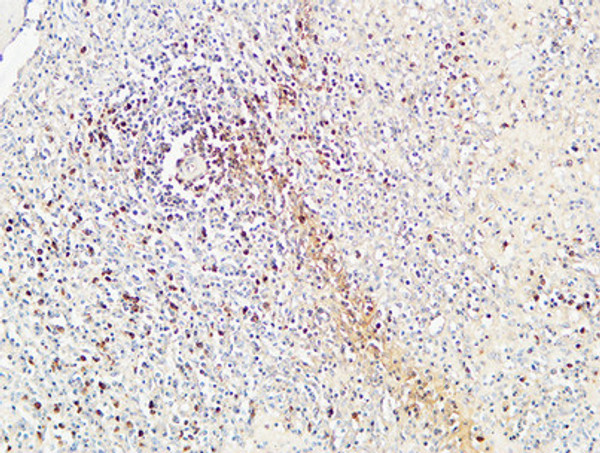 Immunohistochemical analysis of paraffin-embedded Human spleen. 1, Antibody was diluted at 1:100 (4°C overnight). 2, High-pressure and temperature EDTA, pH8.0 was used for antigen retrieval. 3, Secondary antibody was diluted at 1:200 (room temperature, 30min). Immunohistochemical analysis of paraffin-embedded Human spleen. 1, Antibody was diluted at 1:100 (4°C overnight). 2, High-pressure and temperature EDTA, pH8.0 was used for antigen retrieval. 3, Secondary antibody was diluted at 1:200 (room temperature, 30min).