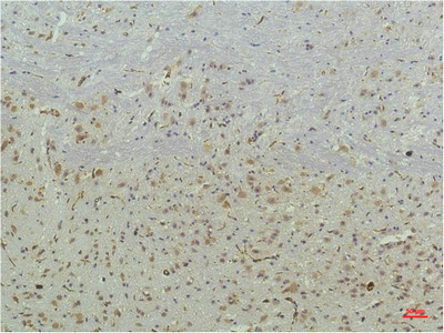 Immunohistochemical analysis of paraffin-embedded Mouse Brain Tissue using PPAR Delta Mouse mAb diluted at 1:200.