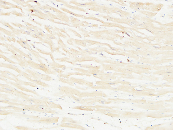 Immunohistochemical analysis of paraffin-embedded Human heart. 1, Antibody was diluted at 1:100 (4°C overnight). 2, High-pressure and temperature EDTA, pH8.0 was used for antigen retrieval. 3, Secondary antibody was diluted at 1:200 (room temperature, 30min).