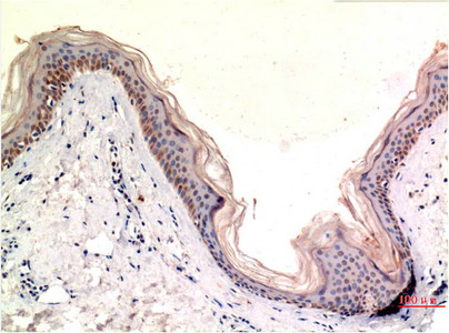 Immunohistochemical analysis of paraffin-embedded Human Skin Tissue using MLKL Mouse mAb diluted at 1:200.