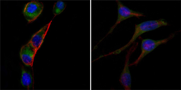 Immunofluorescence analysis of PC-3 (left) and SK-BR-3 (right) cells using AATM monoclonal antibody (green). Red: Actin filaments have been labeled with DY-554 phalloidin. Blue: DRAQ5 fluorescent DNA dye.
