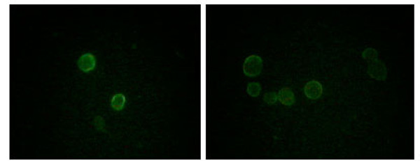 Immunofluorescence analysis of methanol-fixed L-02 (left) and Cos7 (right) cells using ApoM monoclonal antibody showing cytoplasmic and membrane localization. Immunofluorescence analysis of methanol-fixed L-02 (left) and Cos7 (right) cells using ApoM monoclonal antibody showing cytoplasmic and membrane localization.