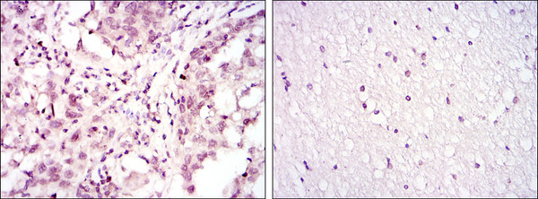 Immunohistochemistry analysis of paraffin-embedded lung cancer (left) and brain tissues (right) with DAB staining using ATF-2 monoclonal antibody.