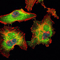 Immunofluorescence analysis of Hela cells using Blk monoclonal antibody (green). Blue: DRAQ5 fluorescent DNA dye. Red: Actin filaments have been labeled with Alexa Fluor-555 phalloidin.