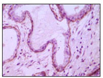 Immunohistochemistry analysis of paraffin-embedded human breast ductal myoepithelium, showing cytoplasmic and membrane location with DAB staining using CD10 monoclonal antibody.