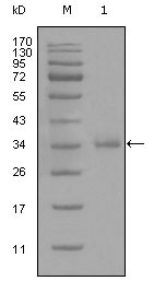 Western blot analysis using CD45 monoclonal antibody against truncated CD45 recombinant protein (1). STJ97930